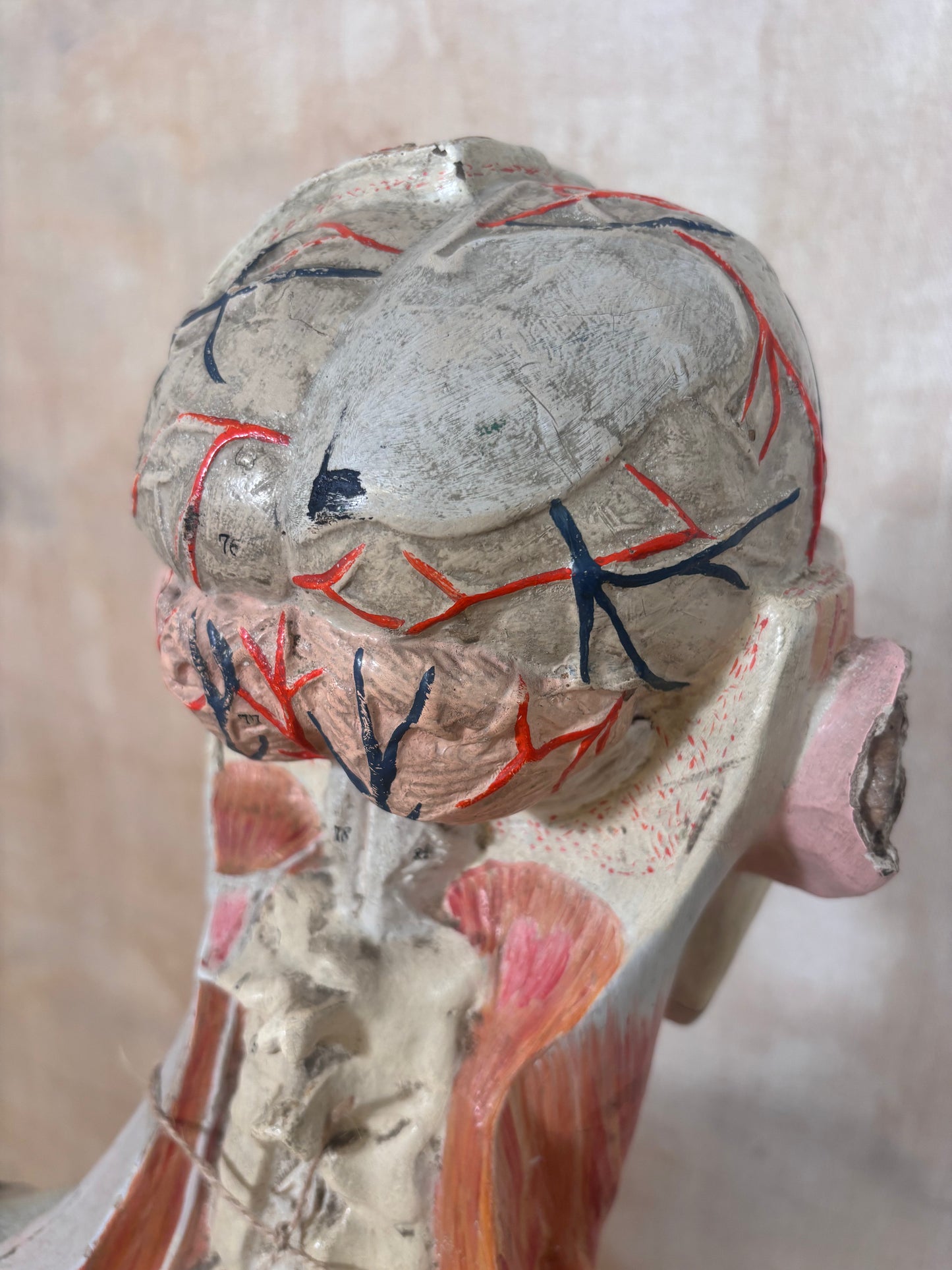 An anatomical model of a human head and neck, showing detailed musculature and internal structures with red and black markings on a neutral background.