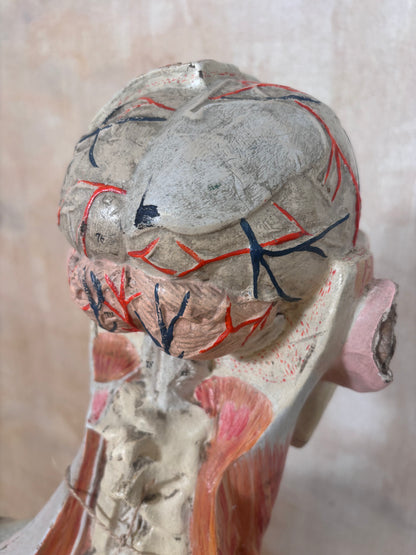 An anatomical model of a human head and neck, showing detailed musculature and internal structures with red and black markings on a neutral background.